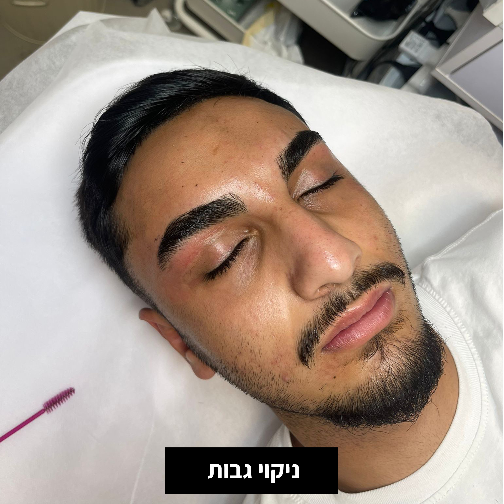 e423f428-2d65-4155-a1fa-a8781303a5f4